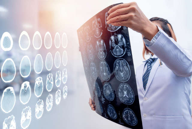 traumatic brain injury